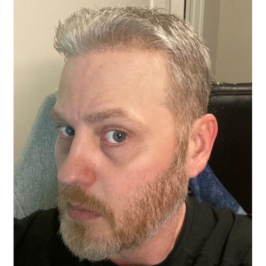 Helios Swiss Lace Hair System for Active Lifestyles | LaVivid Hair