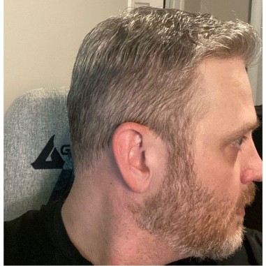 Helios Swiss Lace Hair System for Active Lifestyles | LaVivid Hair Helios Swiss Lace Hair System for Active Lifestyles | LaVivid Hair