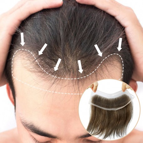 Lace Hair Patch for Men | Covering Receding Hairline