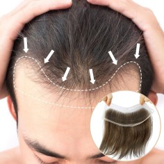 Lace Hair Patch | Covering Receding Hairline In 20 color