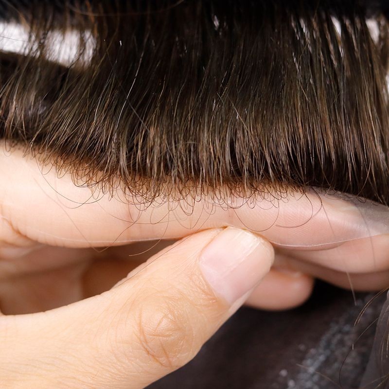 Zeo-Crius Antimicrobial Hair replacement system