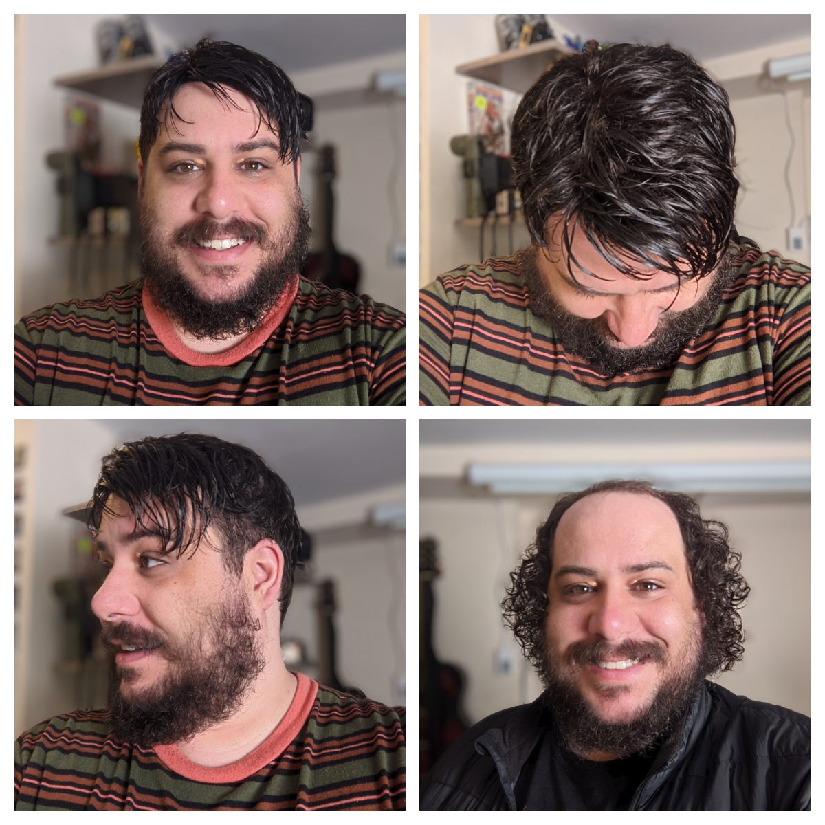 hair system before and after