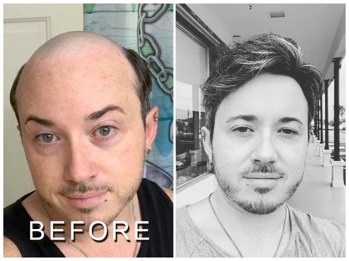 custom made hair system