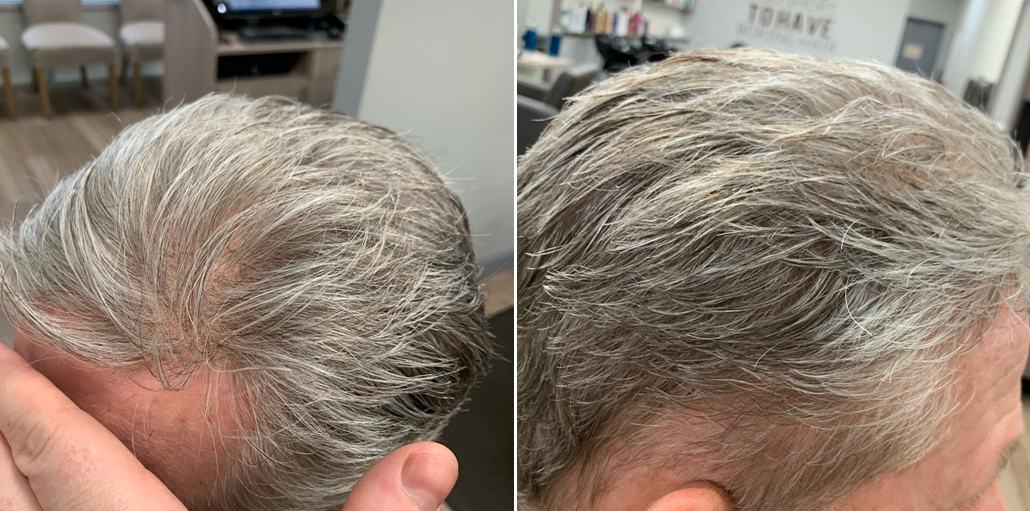 grey hair