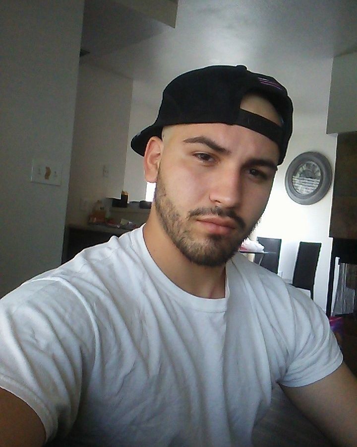 male pattern baldness