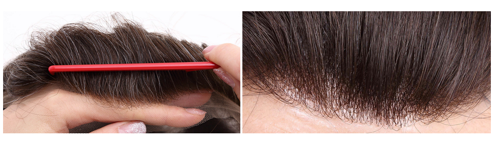 natural looking front hairline