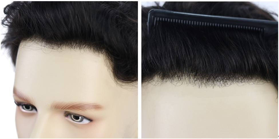 natural-looking hairline