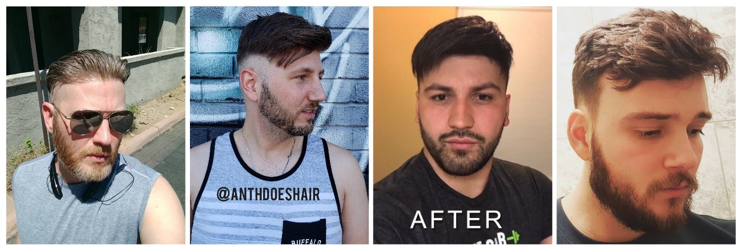 lavivid skin hair systems