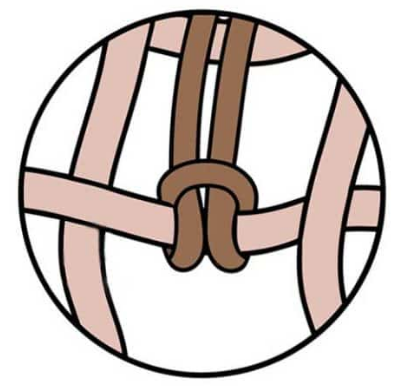 single flat knot